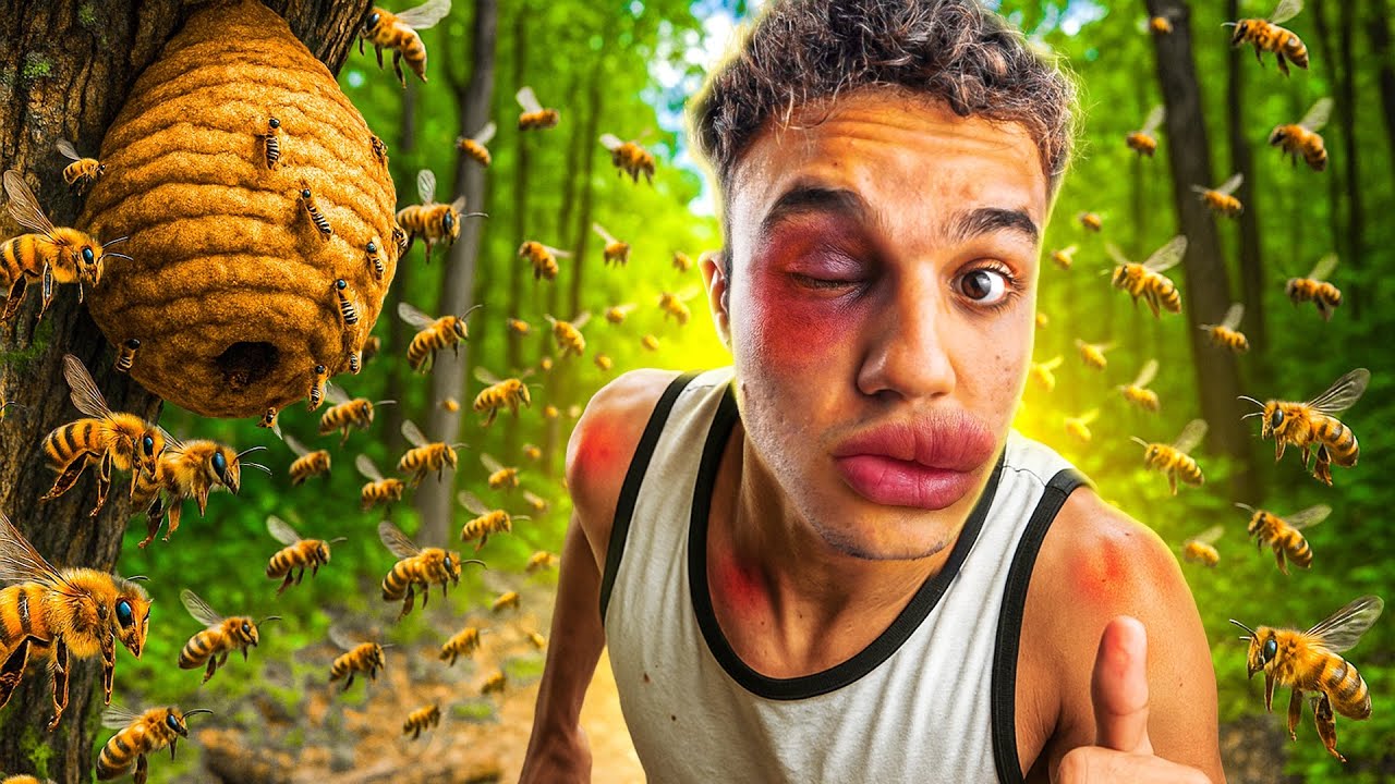 Você Jà Foi Picado Por Abelha?