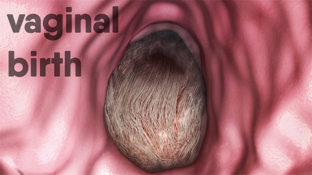 vaginal birth-natural childbirth