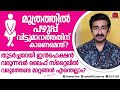 വിട്ടുമാറാതെ മൂത്രത്തിൽ പഴുപ്പ് ഉണ്ടാകാൻ കാരണമെന്ത് ? ജീവിതരീതിയിൽ വരുത്തേണ്ട മാറ്റങ്ങൾ എന്തെല്ലാം?