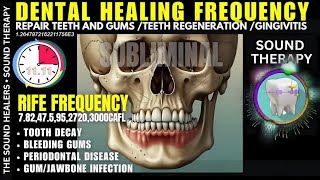 Download Lagu RIFE Biorife® teeth and gums - cavities sound therapy - gingivitis music - binaural beats subliminal MP3 Download Lagu RIFE Biorife® teeth and gums - cavities sound therapy - gingivitis music - binaural beats subliminal MP3