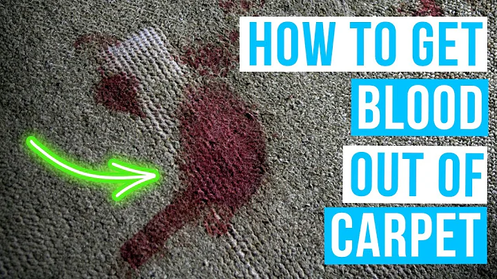 How to GET BLOOD OUT OF CARPET | Hydrogen peroxide for stains