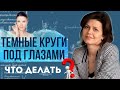 Как избавиться от темных кругов под глазами | Причины синяков под глазами