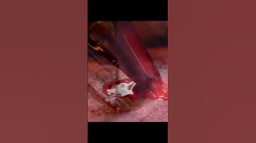 Cận cảnh kim đâm #beauty #phunmoi #phunxammoi #phunxamthammy