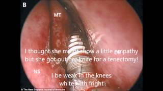 Implant Rap With Caps