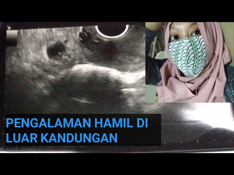 Video: Apakah kandungan EOP?