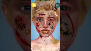Extreme Rotten Face Cleaning ASMR 😱 | Deep Infection &amp; Wound Treatment Animation #asmr #shorts