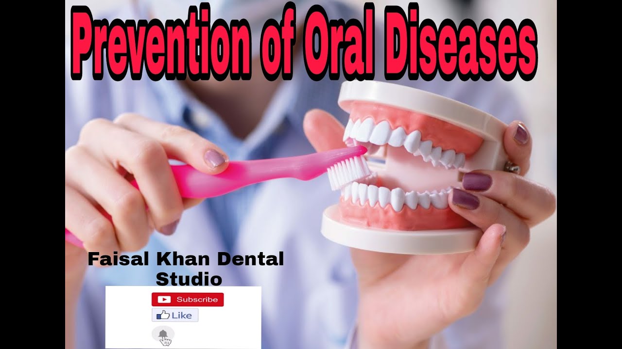 Prevention of Oral Diseases/ Levels of prevention/ Preventive
