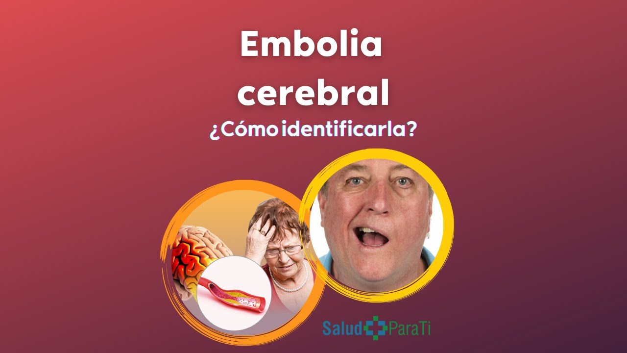 ¿QUÉ ES UNA EMBOLIA CEREBRAL? - YouTube