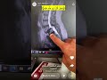 سنابات الدكتور هاني الجهني وفوق ك ل ذ ي ع ل م ع ليم