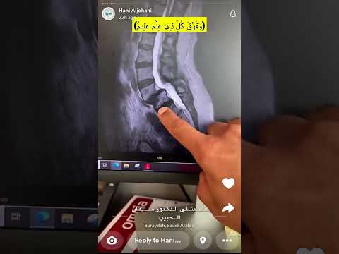 سنابات الدكتور هاني الجهني وفوق ك ل ذ ي ع ل م ع ليم