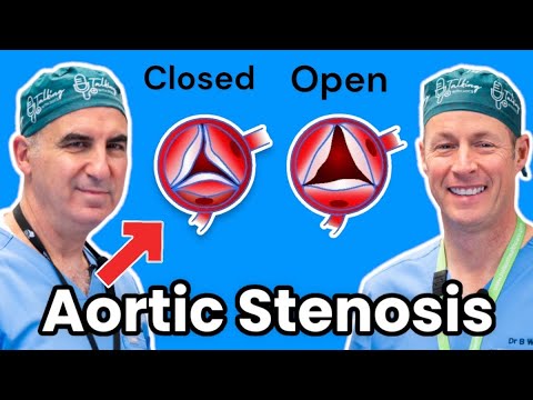Aortic Stenosis and