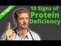 10 Hidden Signs of PROTEIN Deficiency (Watch Carefully) 2022