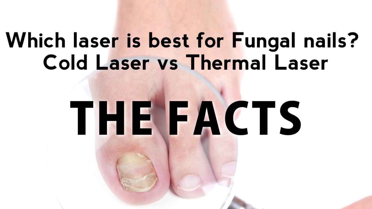 Laser Nail Therapy - Rocky Hill CT, Newington CT, Middletown CT,  Glastonbury CT, Bristol CT, and Kensington, CT Foot Doctor