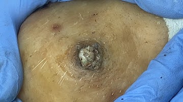 𝑻𝒉𝒆 𝑩𝒆𝒔𝒕 𝑭𝒂𝒄𝒊𝒂𝒍 𝑪𝒍𝒆𝒂𝒏𝒔𝒊𝒏𝒈 𝑹𝒆𝒍𝒂𝒙𝒊𝒏𝒈 & 𝑺𝒂𝒕𝒊𝒔𝒇𝒚𝒊𝒏𝒈 𝒇𝒐𝒓 𝑰𝒏𝒏𝒆𝒓 𝑷𝒆𝒂𝒄𝒆 ✧ 901163