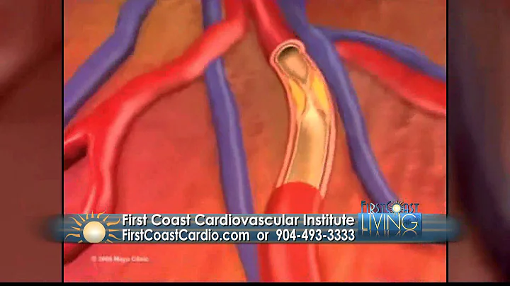 DR. OMER ZUBERI - HEART ATTACK