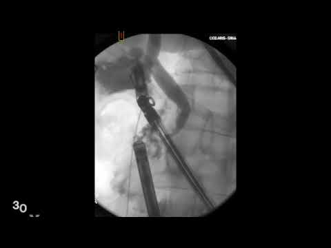 Robotic IOC Jan 2023   SD 480p