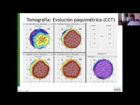 CORNEA PARA JOVENES OFTALMOLOGOS - HORUS PHARMA