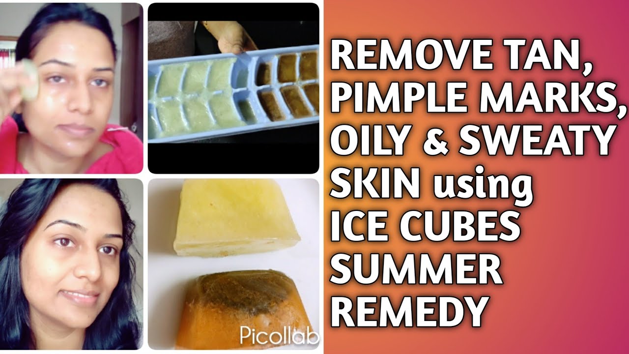 Ice Cube For face / Remove tanning, pimple marks, oily & sweaty skin