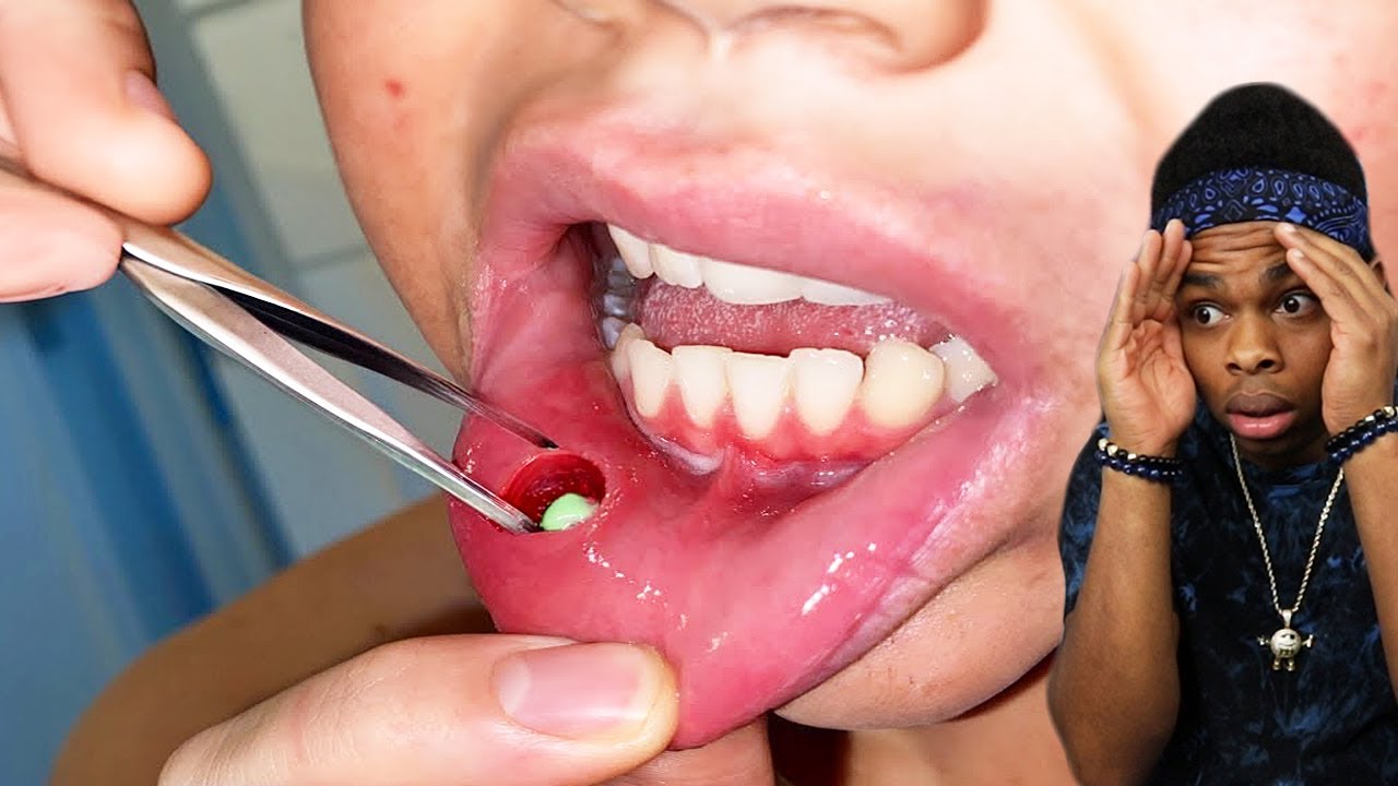 Он думал, что это просто конфеты.