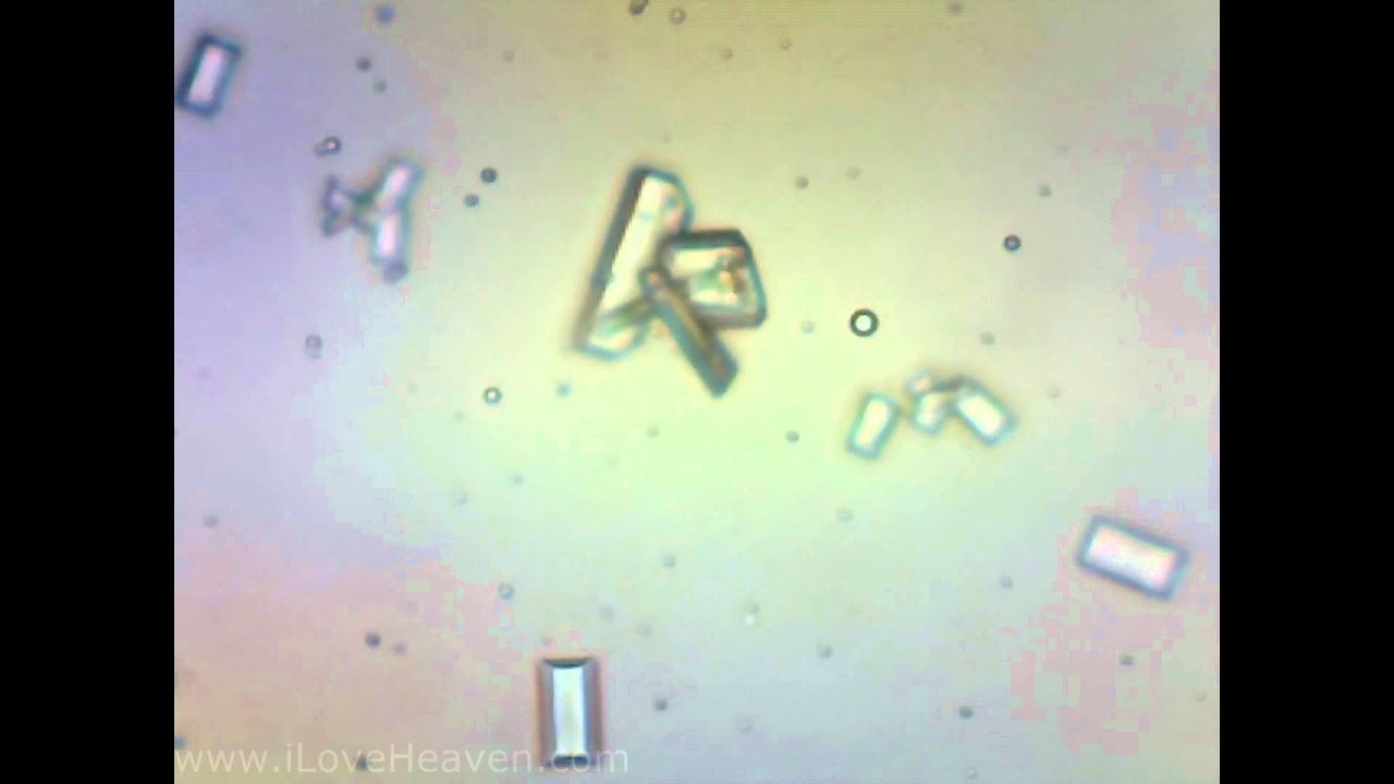 Feline Urine Sample with Struvite Crystals 4+ Microscope 