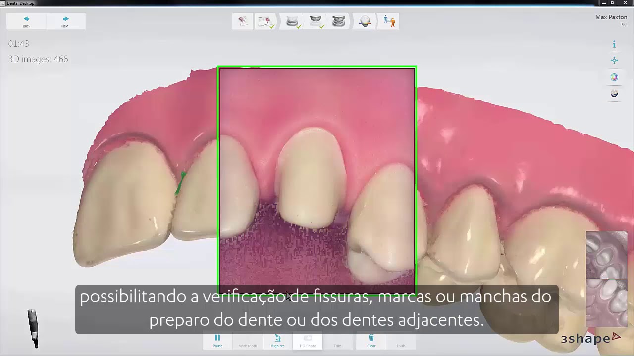 configuração significado 3Shape TRIOS - Fotos em HD