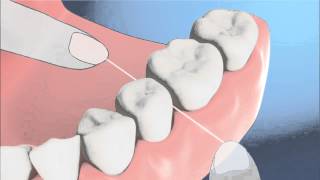 [正しいデンタルフロス使用法]奥歯の歯と歯の間のみがき方