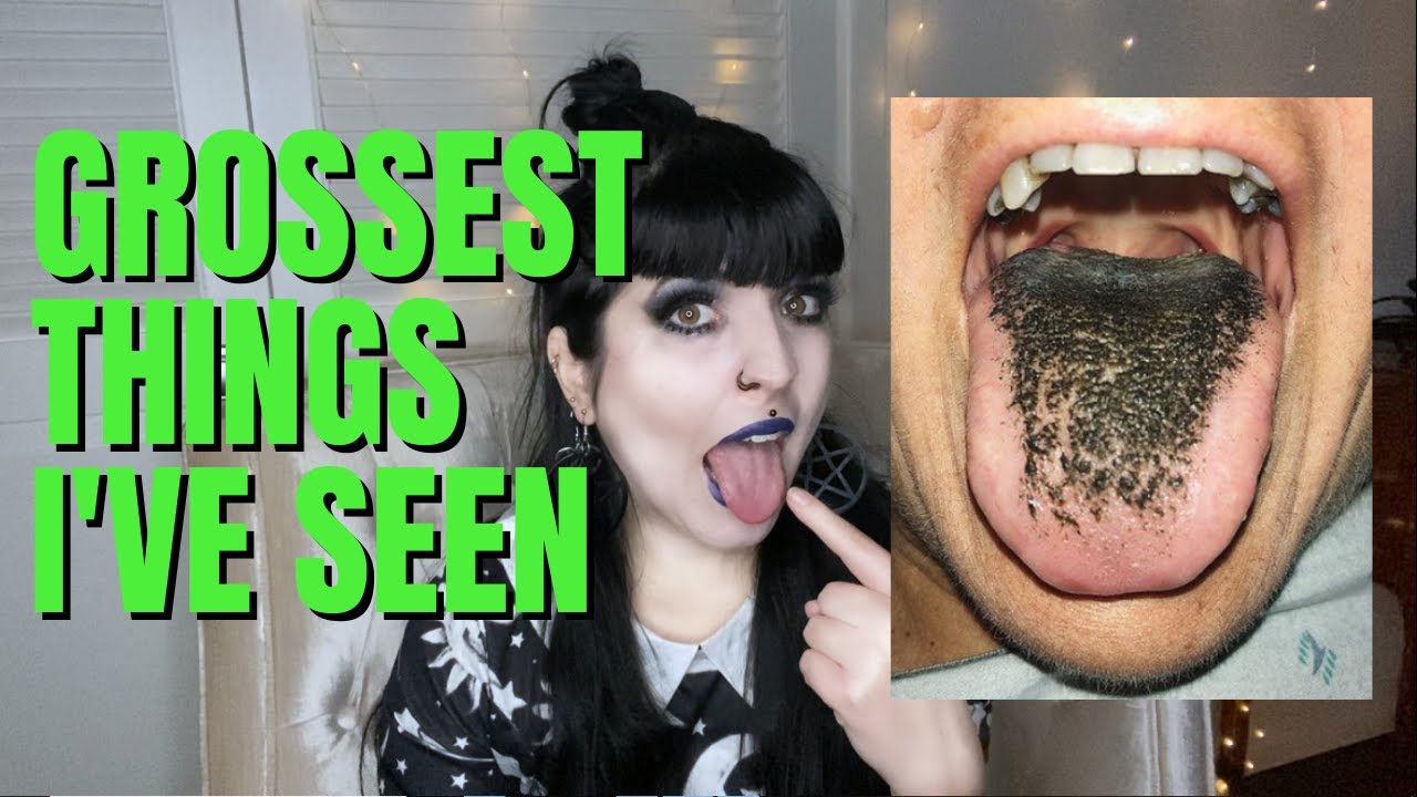 Piercer Recalls the Grossest Things I've Ever Seen - YouTube