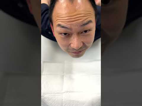 Shonan AGA clinic OSAKA【Double Matrik】ASMR風？ #shorts