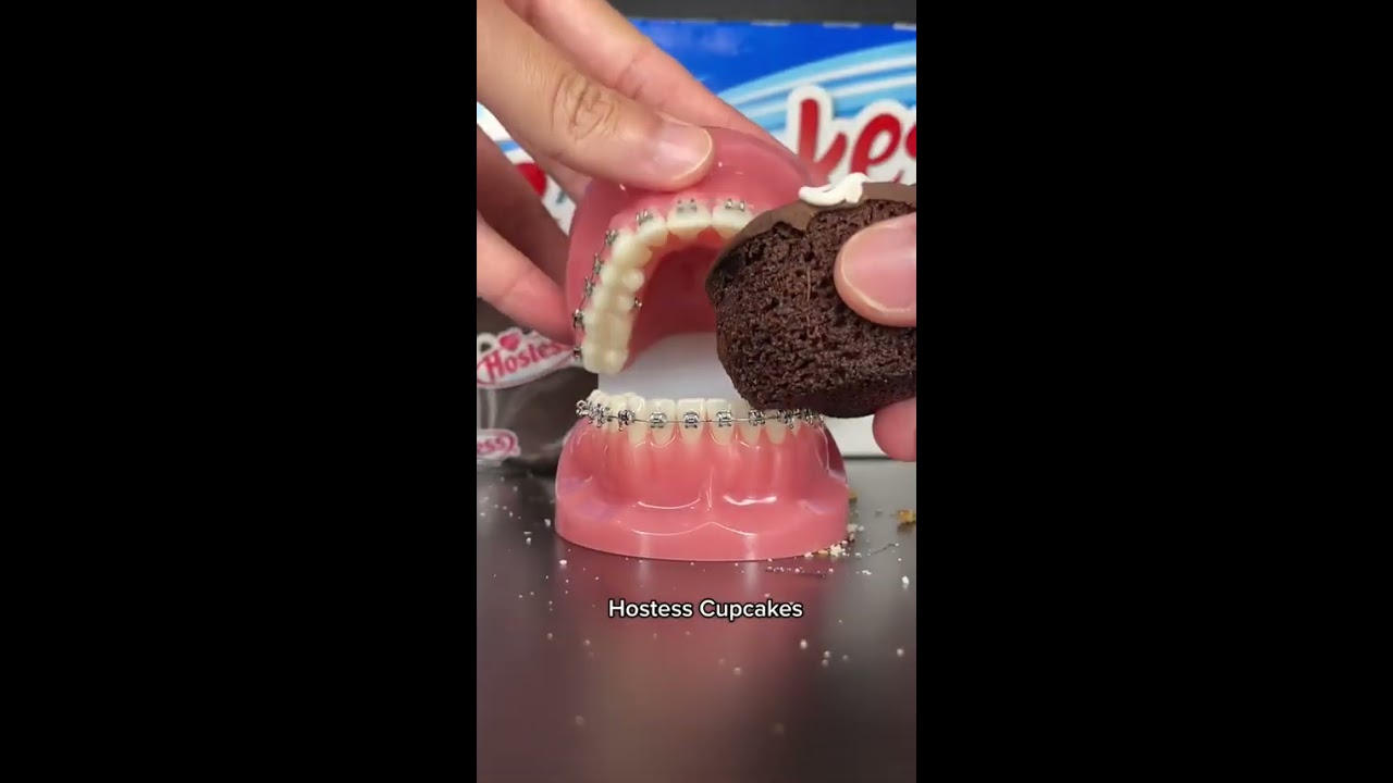 Unhealthy Snacks You Can Eat With Braces