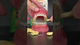Unhealthy Snacks You Can Eat with Braces screenshot 4