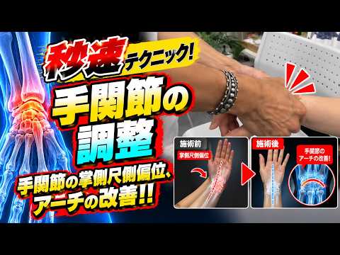 手関節の調整（上肢の治療技術動画）
