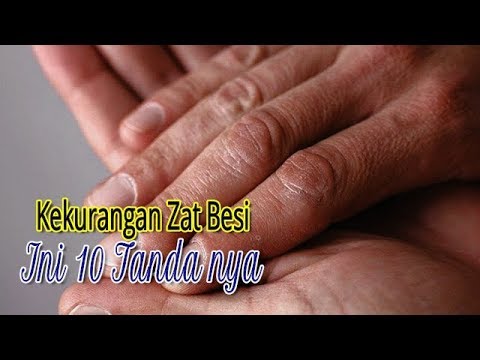 Kekurangan Zat Besi, Ini 10 Tanda nya