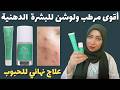 أفضل مرطب ولوشن للبشرة الدهنية المعرضة للحبوب ✨ تجربتي مع منتجات دوتس 💧 أفضل علاج للحبوب الملتهبة ✅