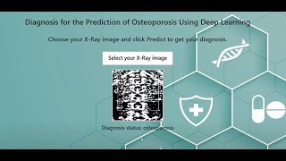 Osteoporosis Disease Detection | CNN | Deep Learning | Machine Learning | Python  | College Project