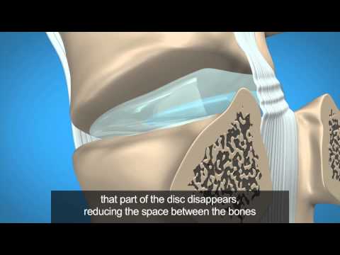 [Treatment] Chuna Manipulation - A Better Solution for Spinal Disorders