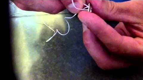 Sliding Endobuttons syndesmosis technique