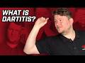 I had Dartitis - This is how I beat it!