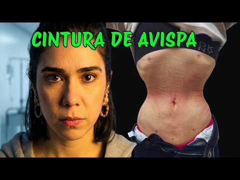 Se Quitaron Las Costillas Para Encajar En Un Vestido: Lo Que NADIE Te Cuenta Sobre Esta Operación