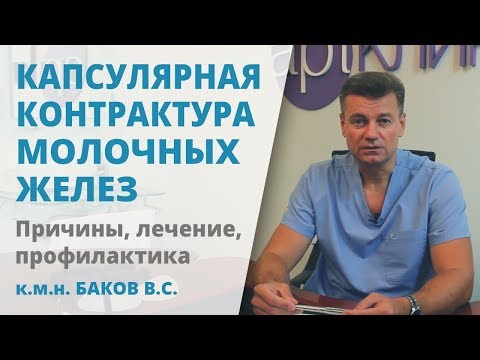 Видео: Нужно ли лечить капсулярную контрактуру?