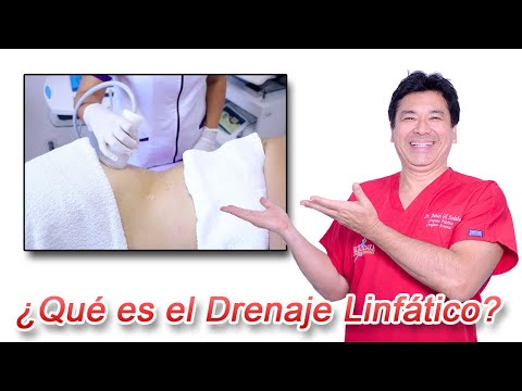 Video: Que Es El Drenaje