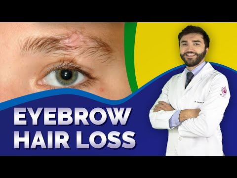 How To Treat Eyebrow Hair Loss