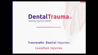 9. Traumatic Dental Injuries: Part 2: Luxation Injuries, Type 2: Subluxations