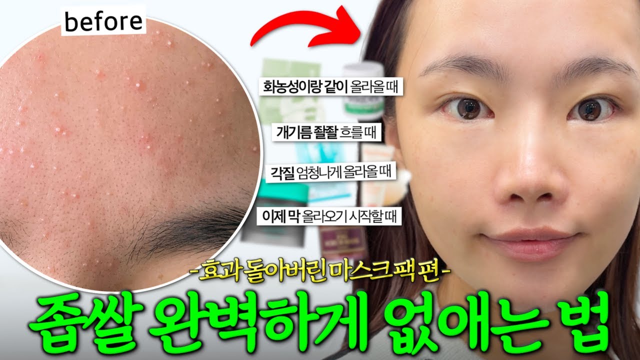 좁쌀 싹 없어짐. 팩으로 피지+진정관리 끝✔️ 좁쌀 올라올 때? 빨갛고 아플 때? 상황별 마스크팩 싹 정리해드림