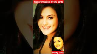 Life Journey transformation of Priety Zinta from 1975 #transformation #shorts #youtubeshorts