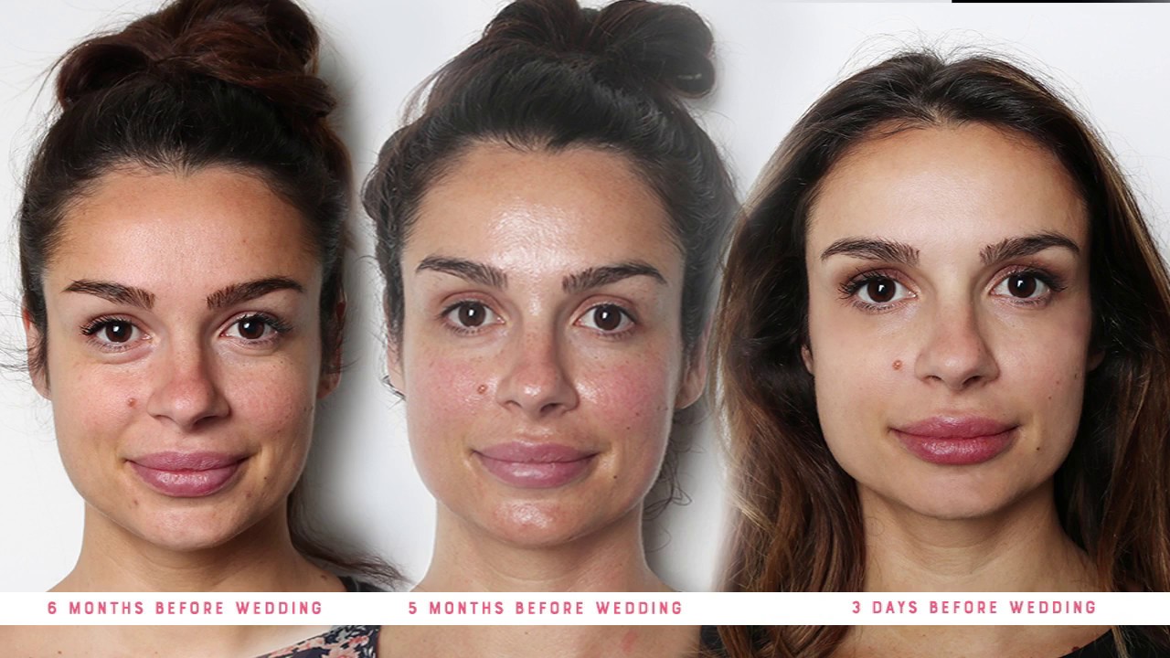 Must for every bride: Marija’s Journey FACE PLUS MEDISPA camera iphone 8 plus apk