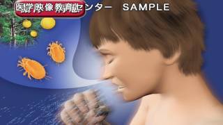 病気の基礎知識 病気の成因・病態と治療 – 医学映像教育センター