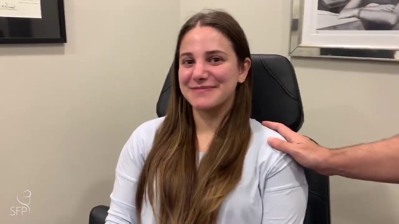 Closed Rhinoplasty Toronto 6 Weeks Posop Appointment Dr. Philip