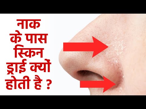 वीडियो: अपने चेहरे पर पपड़ी को कैसे ढकें: 12 कदम (चित्रों के साथ)