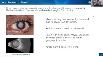 Robotic VHF-Ultrasound in Glaucoma, Refractive, Corneal, and Oncologic Patients by Dr. Rick Behrens