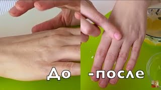 ПРОСТОЙ СПОСОБ СДЕЛАТЬ РУКИ МОЛОДЫМИ И УХОЖЕННЫМИ ЗА 1 МИНУТУ! ПРОСТОЙ СПОСОБ СДЕЛАТЬ РУКИ МОЛОДЫМИ И УХОЖЕННЫМИ ЗА 1 МИНУТУ!